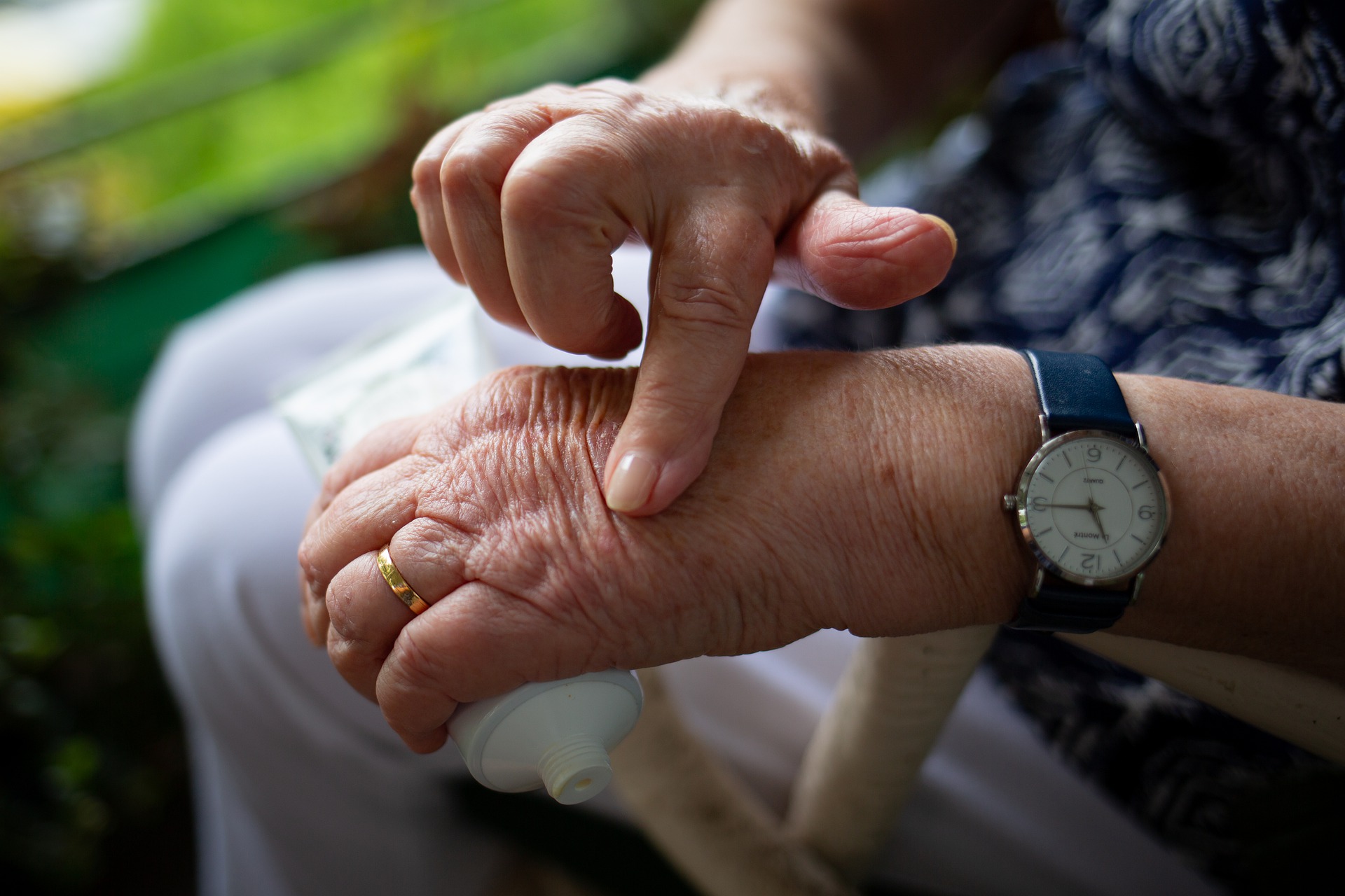 rheumatoid arthritis